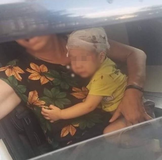 Bé trai bị chổi lau nhà rơi trúng đầu ở chung cư. (Ảnh: FB).