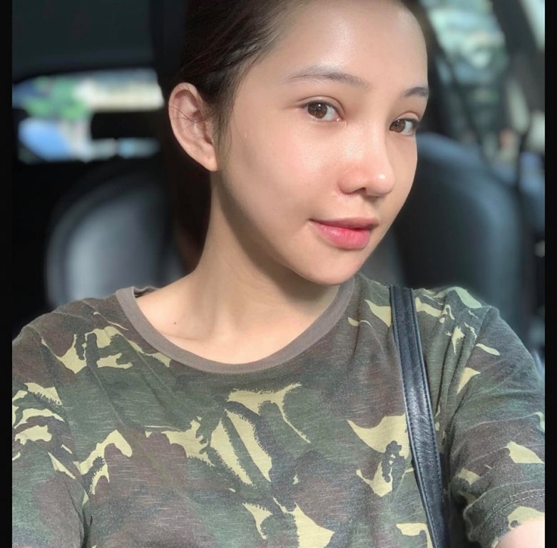 Sau một tháng, gương mặt của Lưu Đê Ly gần như đã lành lặn. 