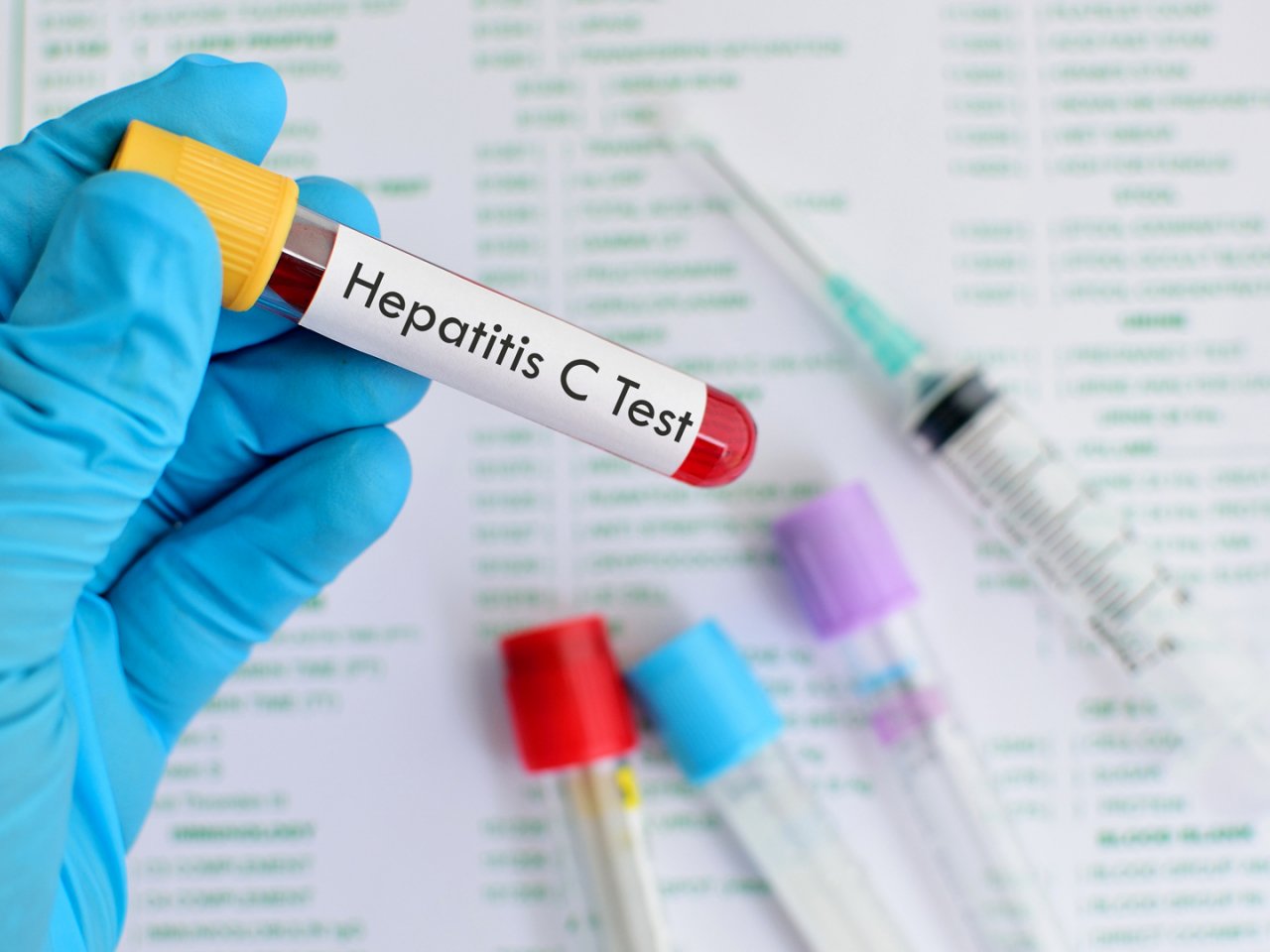 hcv ab là gì2