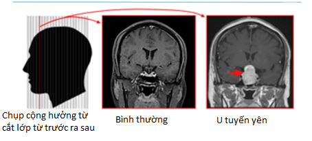 mat-mo-dan-du-da-thay-thuy-tinh-the-nguoi-phu-nu-bang-hoang-khi-bac-si-tim-ra-nguyen-nhan