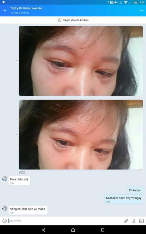 tham-my-vien-lavender-lien-tuc-bi-xu-phat-ba-chu-ly-thuy-chang-la-ai