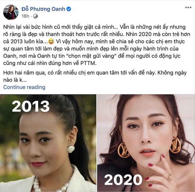 “Quỳnh Búp Bê” Phương Oanh tự so sánh nhan sắc gây tranh cãi trước và sau 7 năm, công khai chuyện “dao kéo”