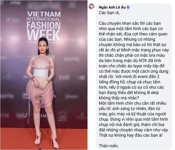 Lê Âu Ngân Anh giải thích rõ mọi đồn đoán về nhan sắc khác lạ và nghi vấn trang phục để lộ vùng nhạy cảm