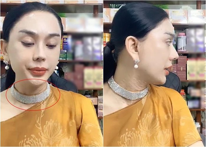 Lâm Khánh Chi gây rùng mình với vùng cổ nhăn nheo, chi chít nốt sần