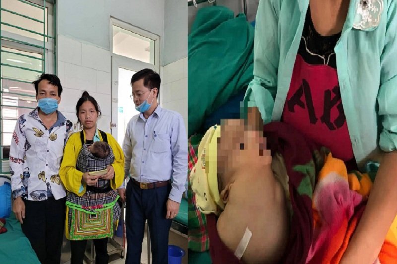 Trường hợp cháu bé có khối u 'khủng' mà ông Đoàn Ngọc Hải nhắn nhủ mong giúp đỡ.