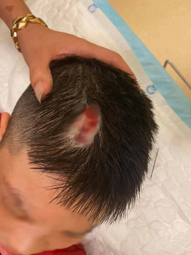 Bé trai bị thương phải cấp cứu tại Bệnh viện gần đó