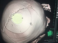 Post cover 1159227