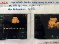 Post cover 1166412