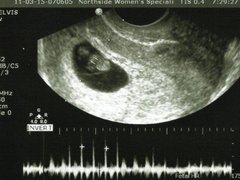 Post cover 1103692