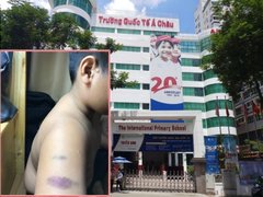 Post cover 1123443