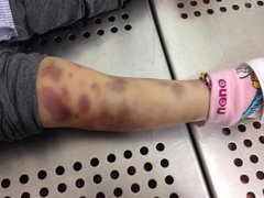 Post cover 1117367